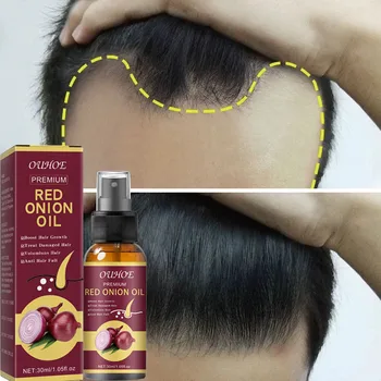 Мощный спрей-сыворотка для роста волос Против выпадения, восстанавливающий, питающий Корни, восстанавливающий Рост волос, средство по уходу за волосами для мужчин и женщин